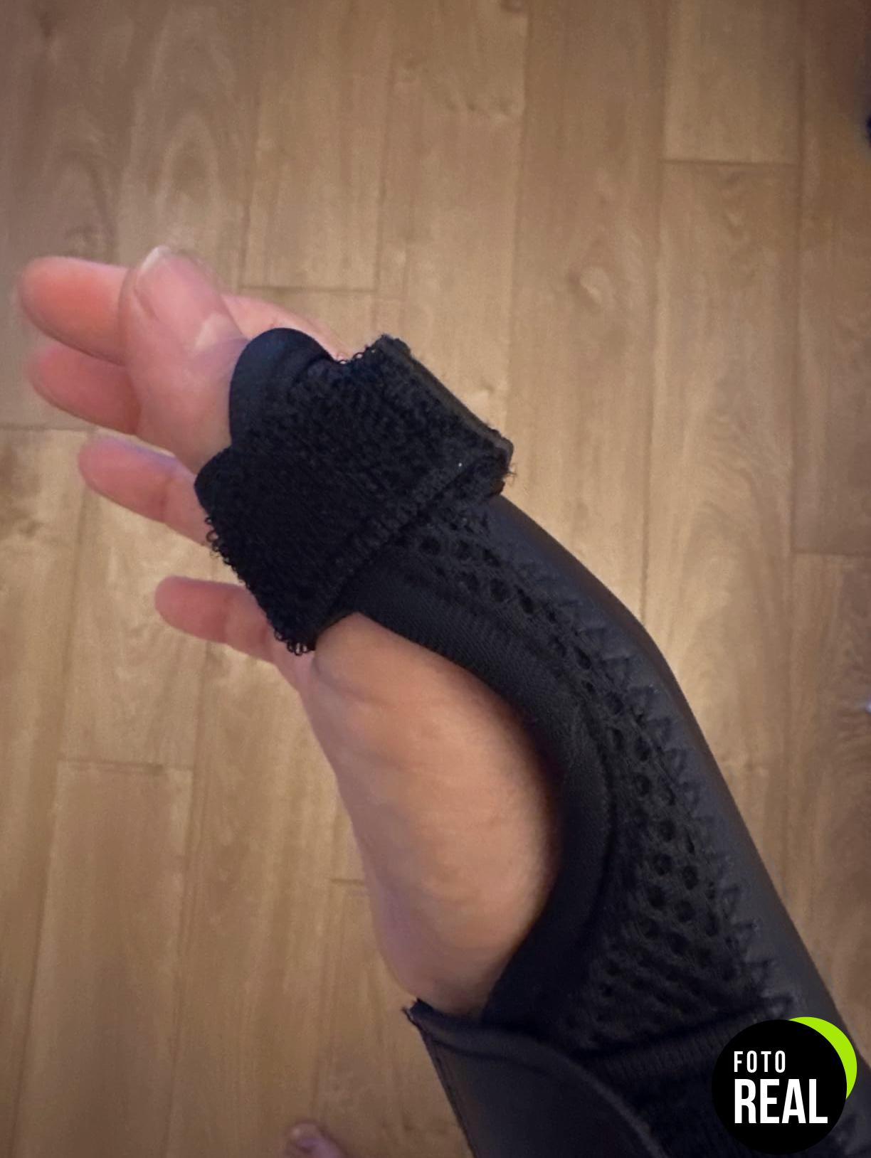 fasola-munequera-pulgar-2-ferulas-foto-1