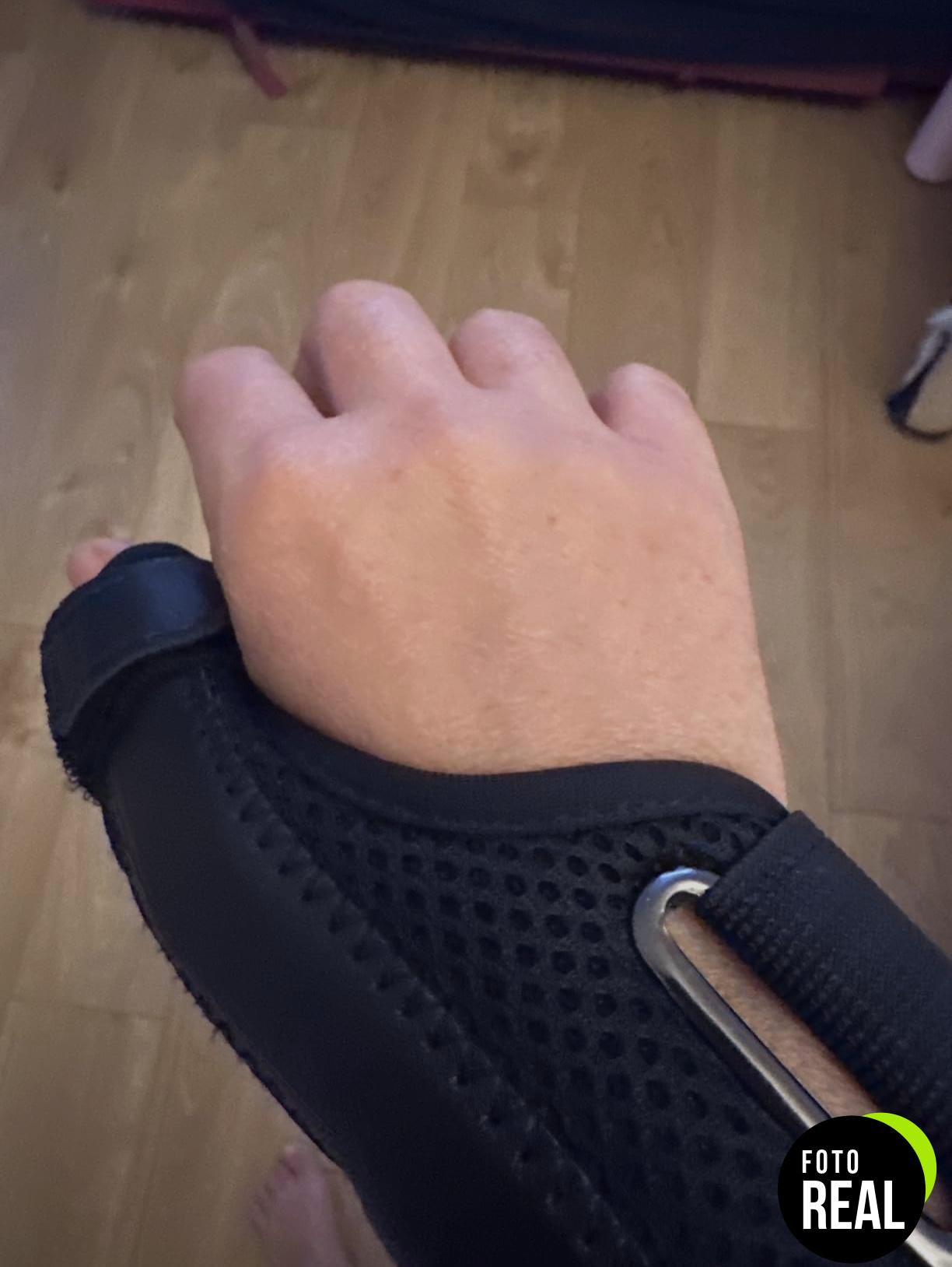 fasola-munequera-pulgar-2-ferulas-foto-2